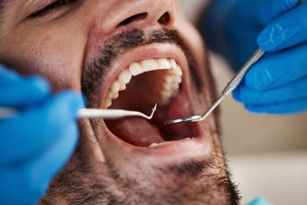 Best Walk-In Emergency Dental Services in Rkside, PA