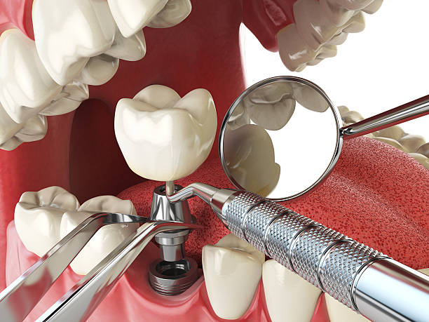 Best Emergency Treatment for Jaw Pain or Injury in Rkside, PA